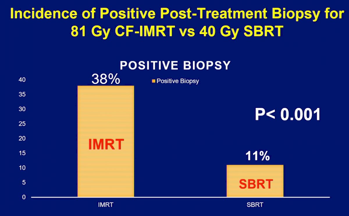 ASTRO 2022: Superior Post-Treatment Biopsy Outcomes With High Dose SBRT ...